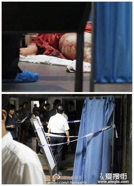 深圳女护士电梯意外：电梯夹头事件引发关注