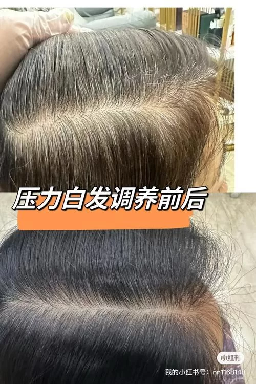 白头发拔了会越长越多？蚂蚁庄园告诉你真相！