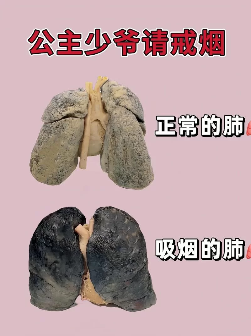 吸烟者的肺图片对比：健康肺与病肺的差异