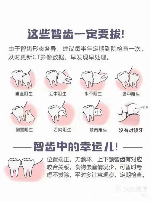 嘴里长智齿是拔还是不拔？医生建议是什么？