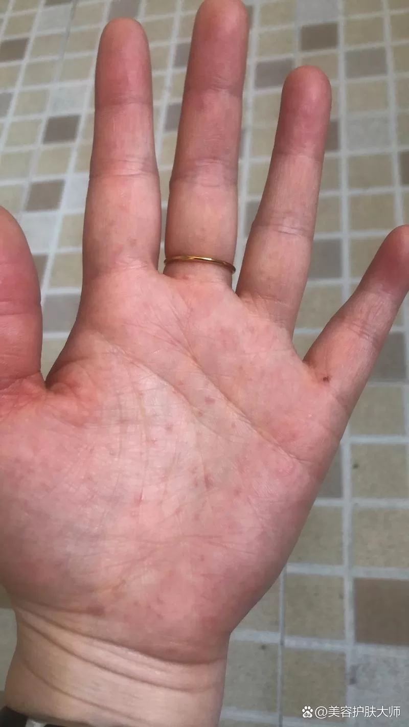 为什么摸铁架后手上会有怪味？蚂蚁庄园今日答案揭晓！