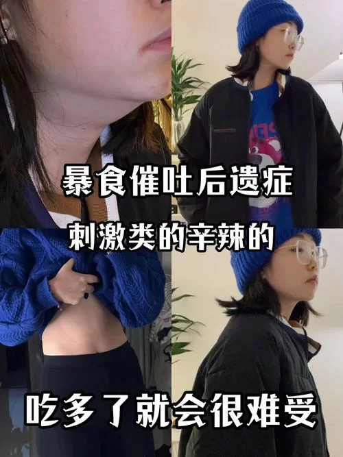 食物中毒要不要催吐？什么情况下不能催吐？