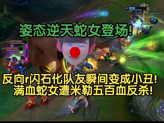 蛇女反向R闪教学：轻松秀翻全场，学会这个操作你就是大神