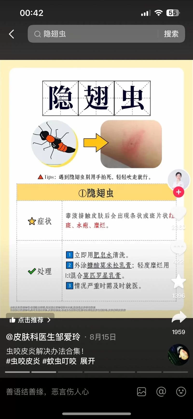 虫虫助手怎么用？虫助手详细教程，快速上手！