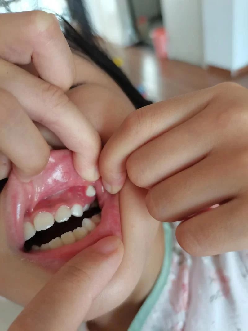 还在找三枚奇异的牙齿?这篇文章告诉你具体位置! 还在找三枚奇异的牙齿?这篇文章告诉你具体位置!