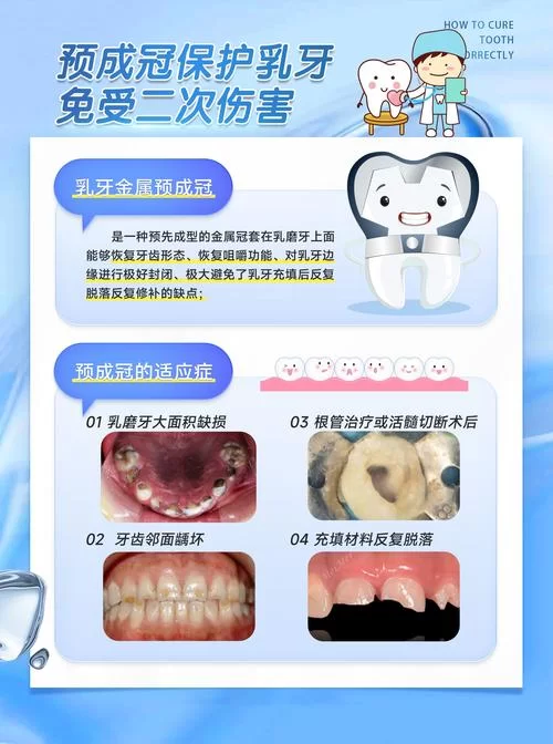 还在找三枚奇异的牙齿?这篇文章告诉你具体位置! 还在找三枚奇异的牙齿?这篇文章告诉你具体位置!