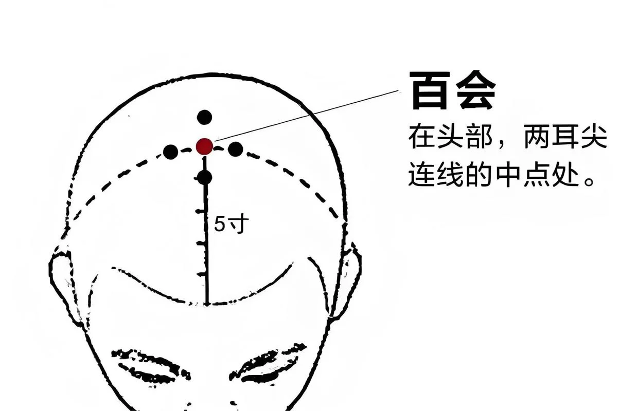 百会穴在哪？中医教你找准这个养生穴！