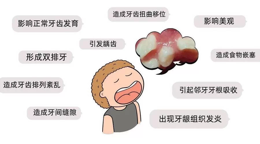 找腐殖之牙的三个牙齿？看这篇攻略就够了！