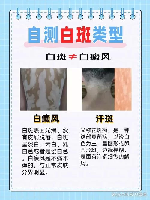 白左和白右区别是什么？这些不同点要知道！