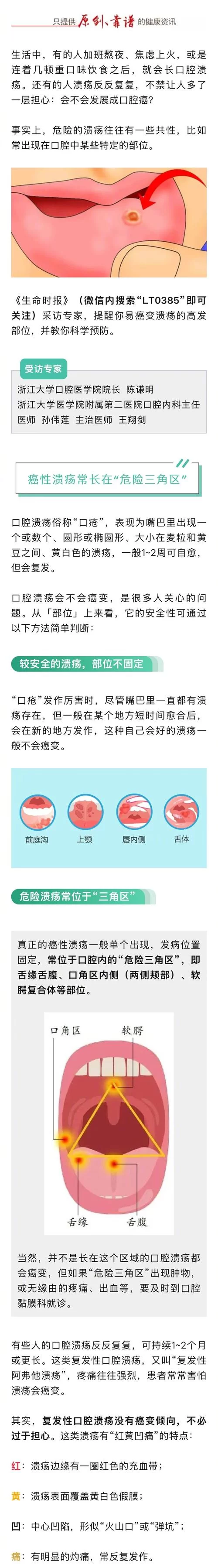 经常听人说pdl，那么pdl是什么意思？