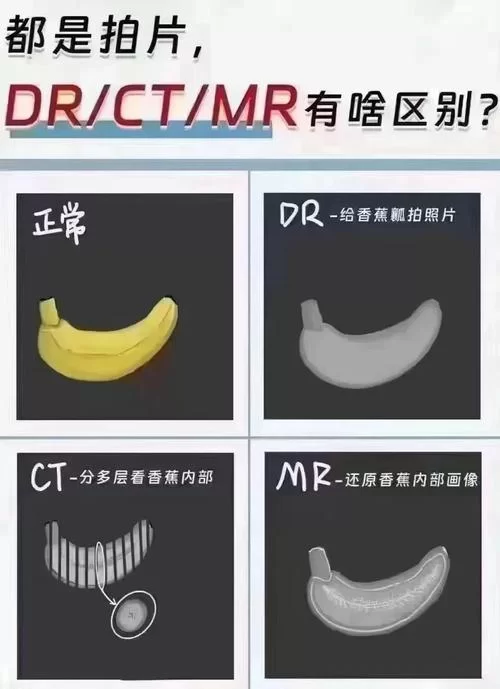 还不知道drs是什么意思？一篇文章给你讲透！