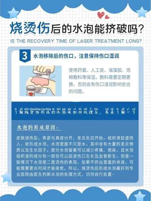 烫伤起泡后如何消肿止痛？热油烫伤的处理方法和预防