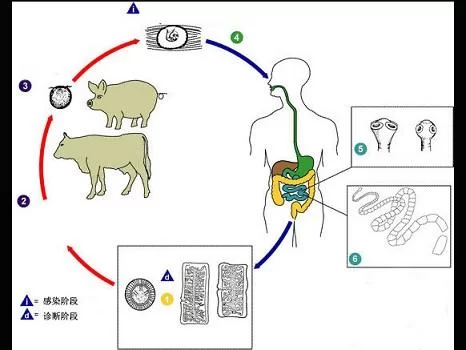 猪肉绦虫病的早期症状是什么？如何判断自己是否感染了？