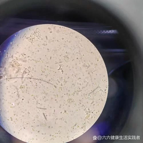 真菌孢子的主要作用是繁殖？还有其他作用吗？