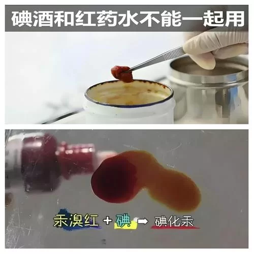 碘酒的溶剂是什么？酒精还是水？简单解答
