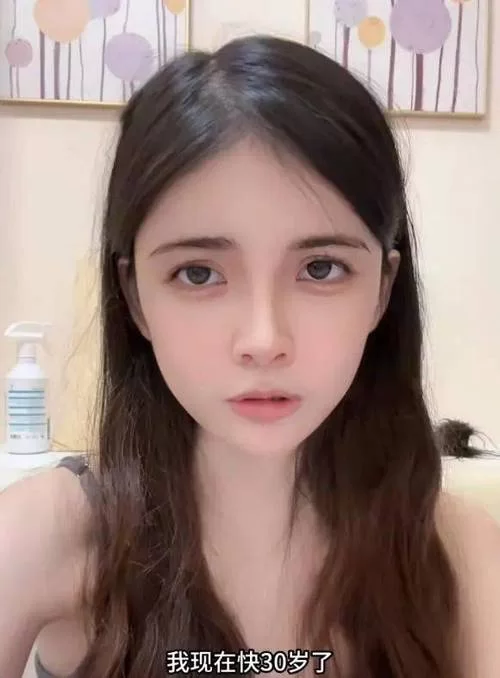 网红白化病萝莉：美貌与疾病的碰撞