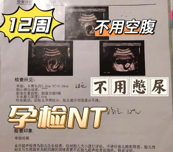 网络热词nt是什么意思？nt梗的多种含义解读