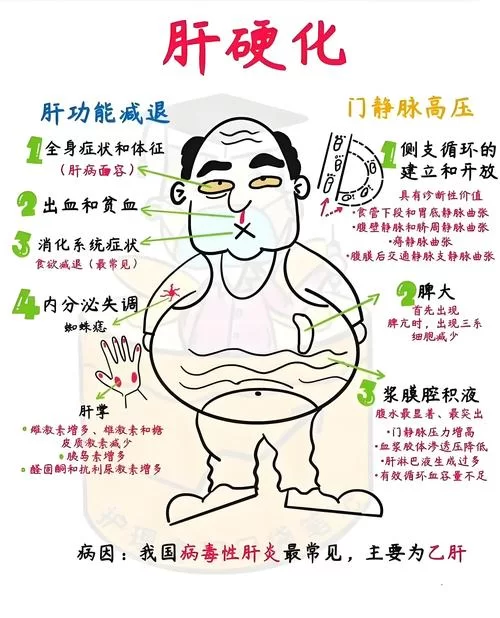 肝硬化F4分级是什么意思？F4肝脏纤维化严重吗