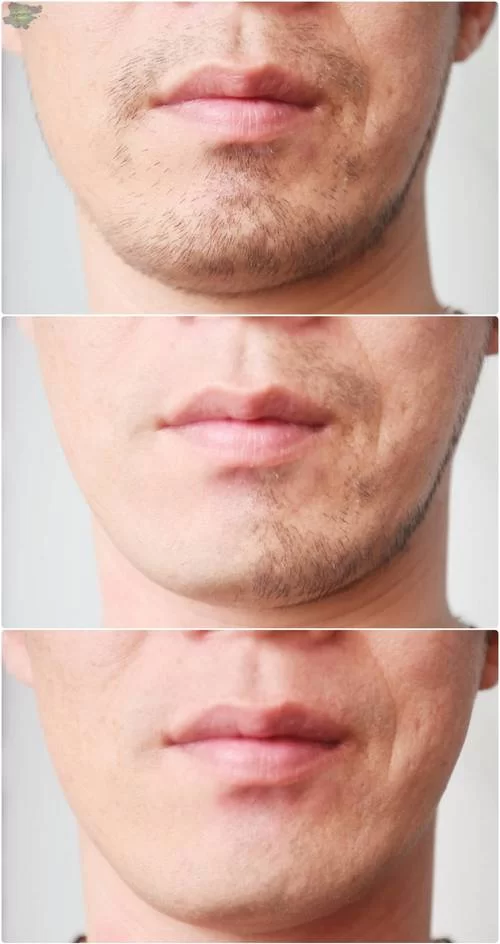 胡渣太顽固刮不干净？掌握这些技巧，轻松告别胡渣烦恼！