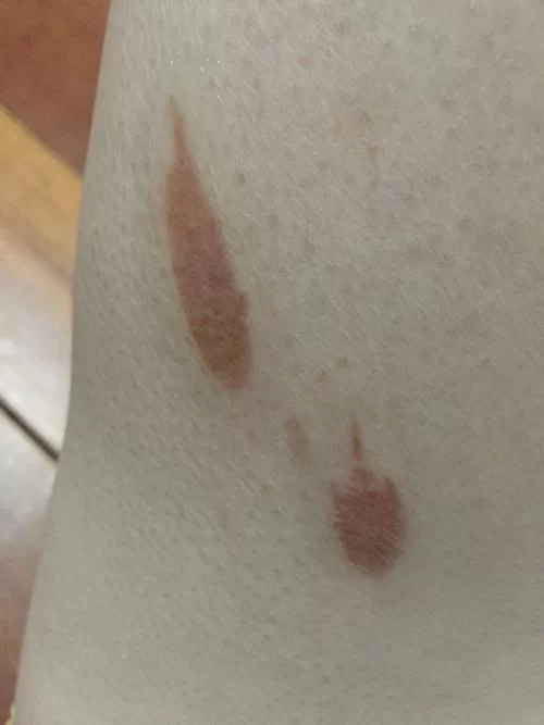 脸上有jy的图片，真实案例分析及解读