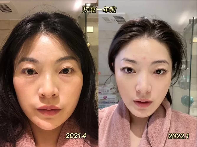 脸上有jy的图片，真实案例分析及解读