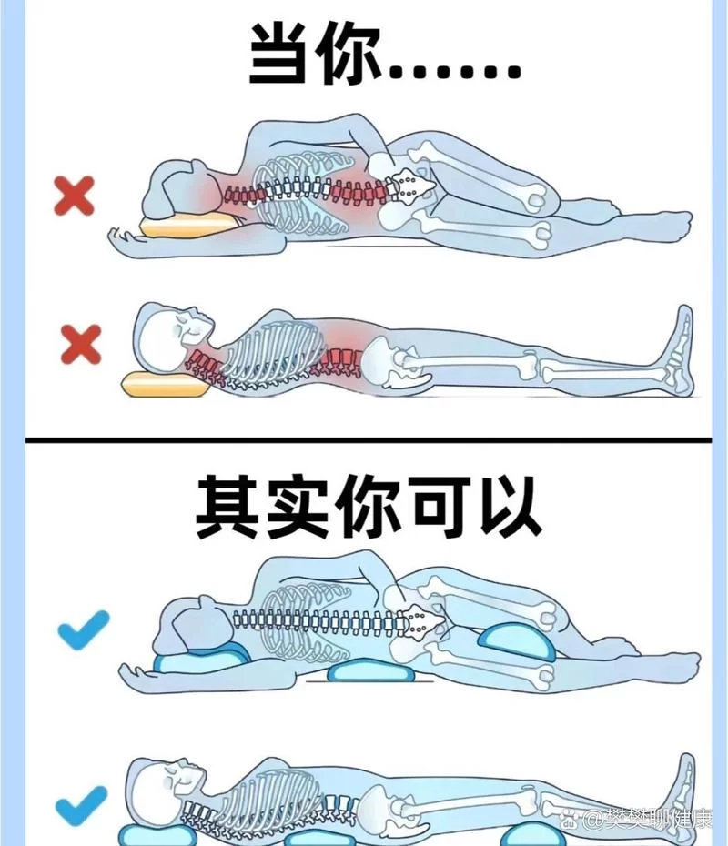 腰椎滑脱要躺多久？100天真的必要吗？