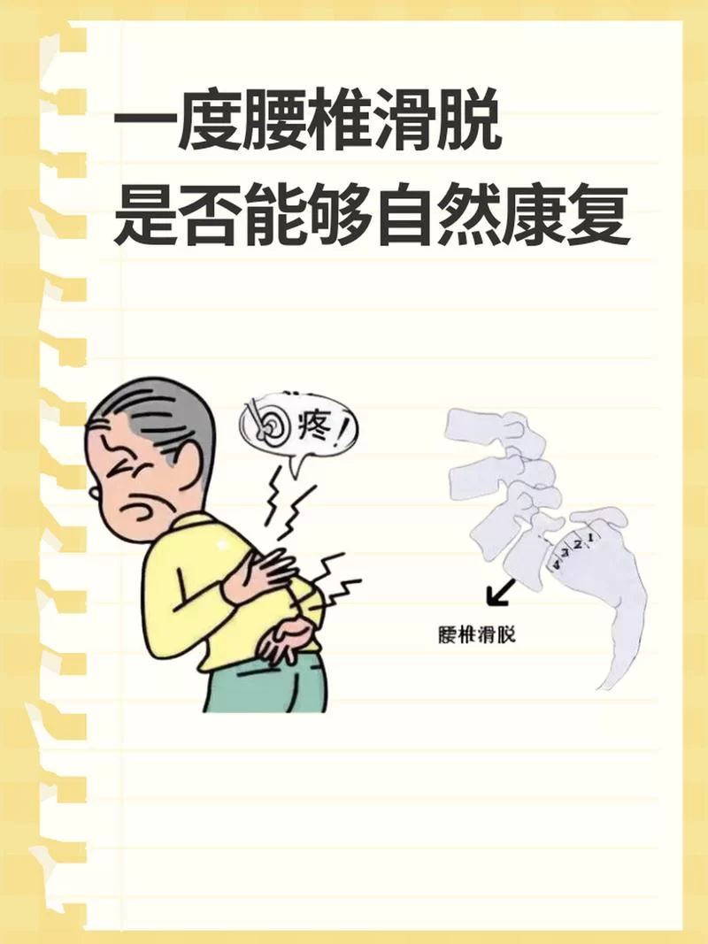腰椎滑脱要躺多久？100天真的必要吗？