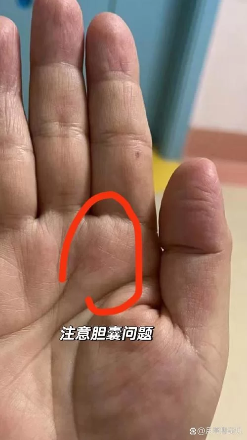 食指有疤痕代表什么？民间说法与科学解释