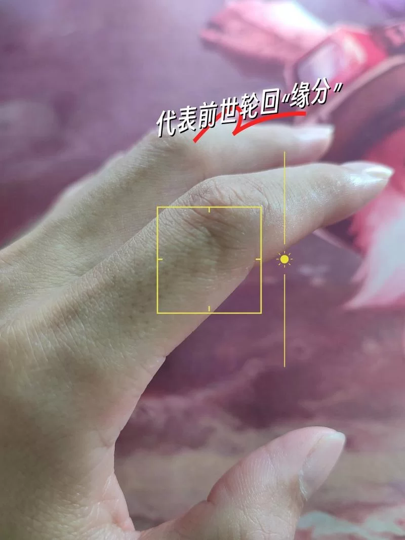 食指有疤痕代表什么？民间说法与科学解释