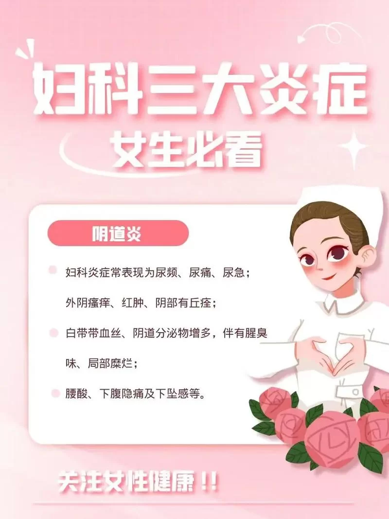 妇科医生最新科普知识来了！女性朋友们赶紧收藏学习！
