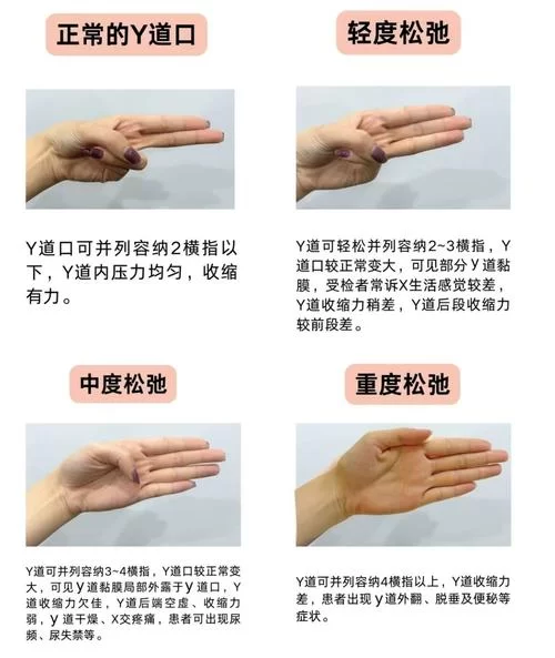 害羞女孩完美改造:从内到外的蜕变技巧大公开! 害羞女孩完美改造:从内到外的蜕变技巧大公开!