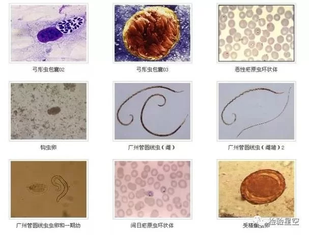 内部寄生虫更新地址常见问题 一键解决指南